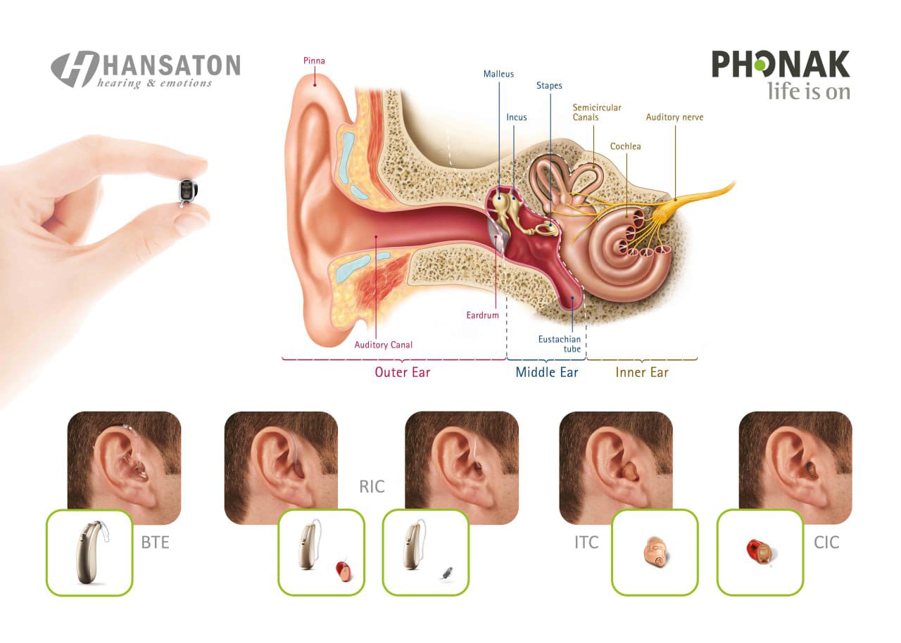 انتخاب سمعک